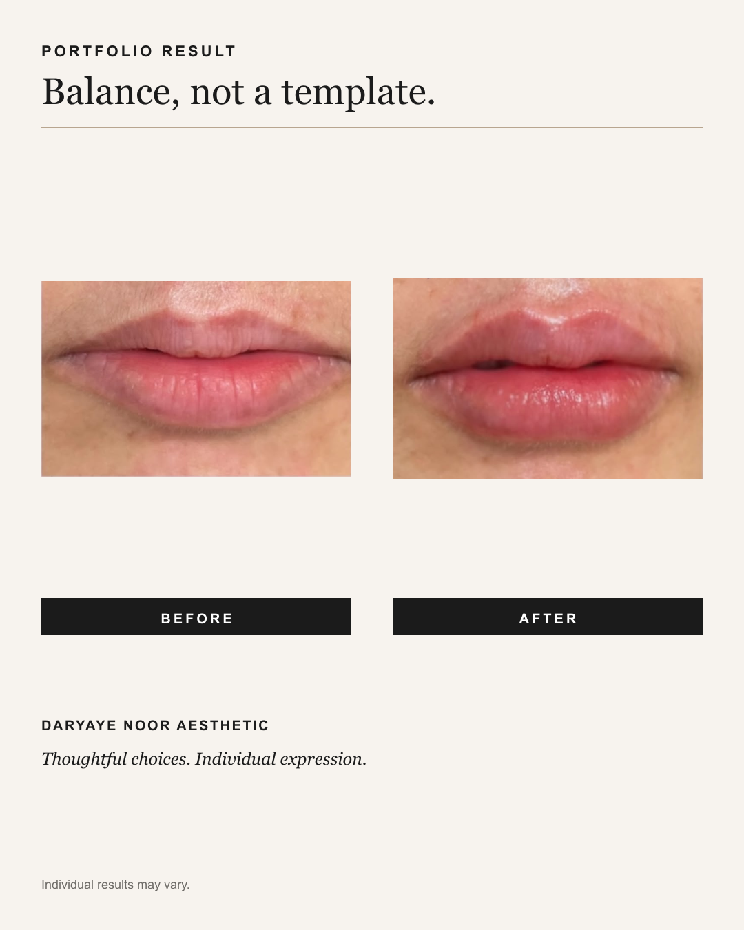 Two original lip photos labelled before and after